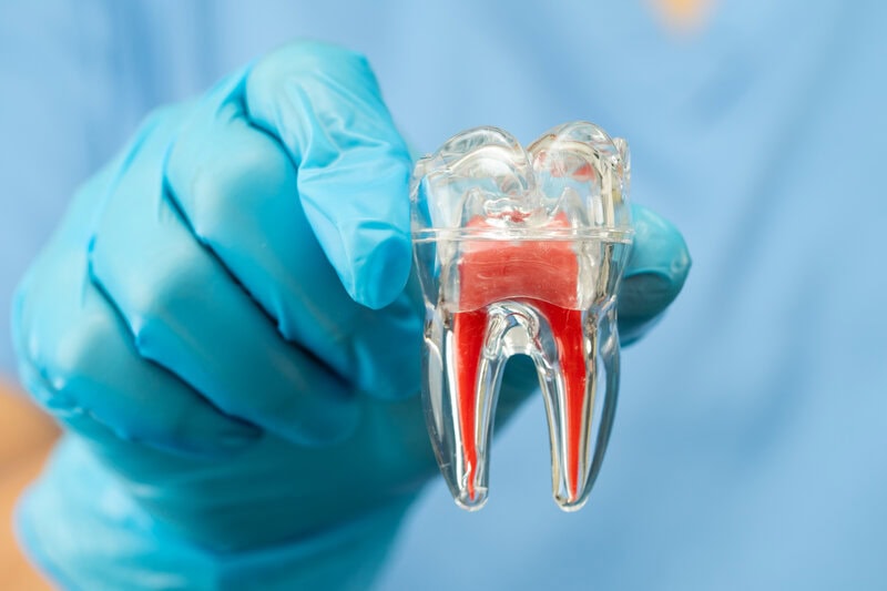 mikroszkópos gyökérkezelés kezelés